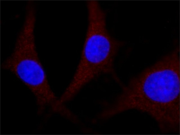 Immunocytochemistry/ Immunofluorescence - Anti-Erk1 (pT202/pY204) + Erk2 (pT185/pY187) antibody [MAPK-YT] (AB50011)