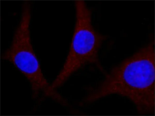 Immunocytochemistry/ Immunofluorescence - Anti-Erk1 (pT202/pY204) + Erk2 (pT185/pY187) antibody [MAPK-YT] (AB50011)