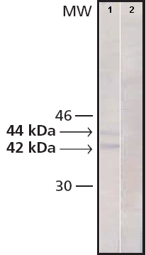 Anti-Erk1 (pT202/pY204) + Erk2 (pT185/pY187) antibody [MAPK-YT]