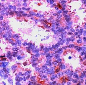 Immunohistochemistry (Formalin/PFA-fixed paraffin-embedded sections) - Anti-ERK2 antibody (AB15282)