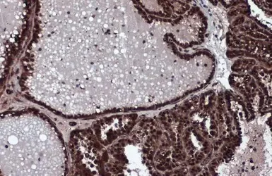 Immunohistochemistry (Formalin/PFA-fixed paraffin-embedded sections) - Anti-ERK2 antibody (AB227134)