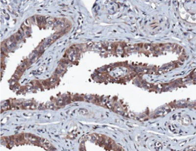 Immunohistochemistry (Formalin/PFA-fixed paraffin-embedded sections) - Anti-ERK2 antibody [E460] - BSA and Azide free (AB214170)