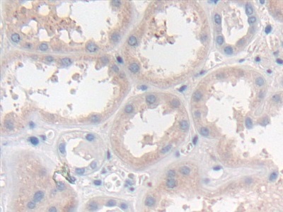 Immunohistochemistry (Formalin/PFA-fixed paraffin-embedded sections) - Anti-ERK5 antibody (AB232748), expandable thumbnail