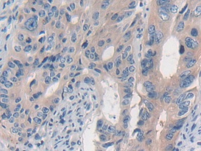 Immunohistochemistry (Formalin/PFA-fixed paraffin-embedded sections) - Anti-ERK5 antibody (AB232748), expandable thumbnail