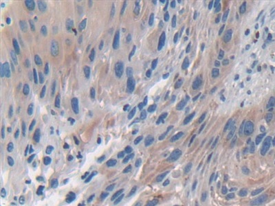 Immunohistochemistry (Formalin/PFA-fixed paraffin-embedded sections) - Anti-ERK5 antibody (AB232748), expandable thumbnail