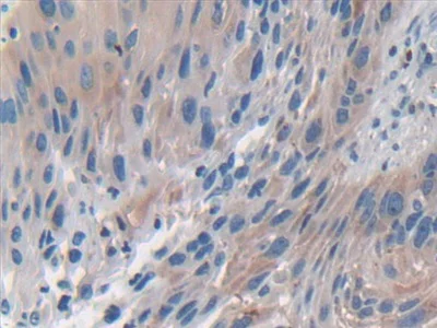 Immunohistochemistry (Formalin/PFA-fixed paraffin-embedded sections) - Anti-ERK5 antibody (AB232748)