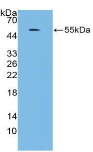 Western blot - Anti-ERK5 antibody (AB232748), expandable thumbnail