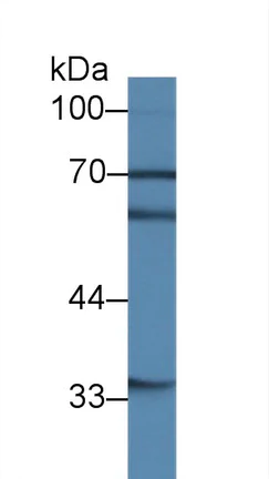 Western blot - Anti-ERK5 antibody (AB232748)