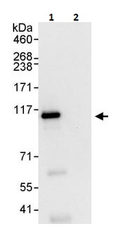 Immunoprecipitation - Anti-ERK5 antibody (AB264300)