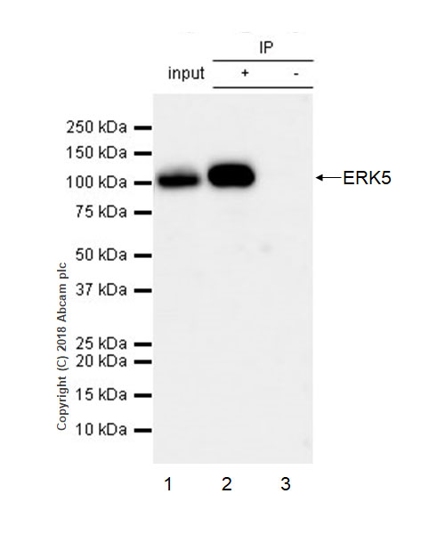 Immunoprecipitation - Anti-ERK5 antibody [EP791Y] (AB40809), expandable thumbnail