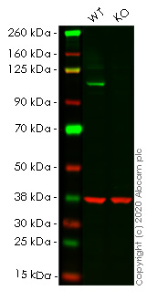 Western blot - Anti-ERK5 antibody [EP791Y] (AB40809), expandable thumbnail