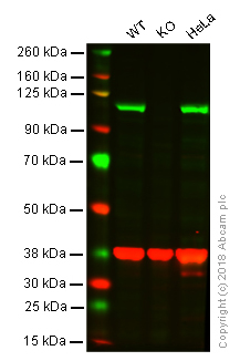 Western blot - Anti-ERK5 antibody [EP791Y] (AB40809), expandable thumbnail