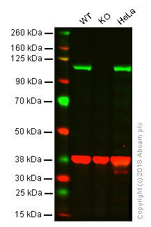Western blot - Anti-ERK5 antibody [EP791Y] (AB40809)