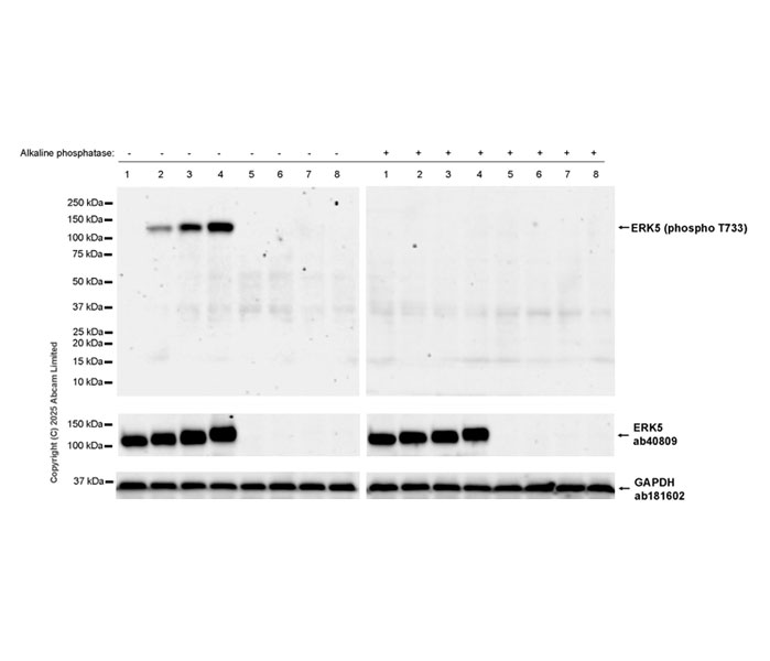 Western blot - Anti-ERK5 antibody [EP791Y] (ab40809), expandable thumbnail