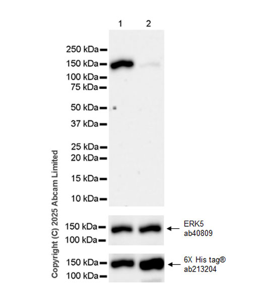Western blot - Anti-ERK5 antibody [EP791Y] (ab40809), expandable thumbnail
