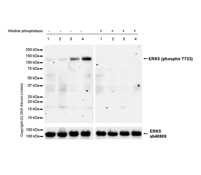 Western blot - Anti-ERK5 antibody [EP791Y] (AB40809)