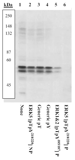 Western blot - Anti-ERK5 (phospho T219 + Y221) antibody (AB5686)