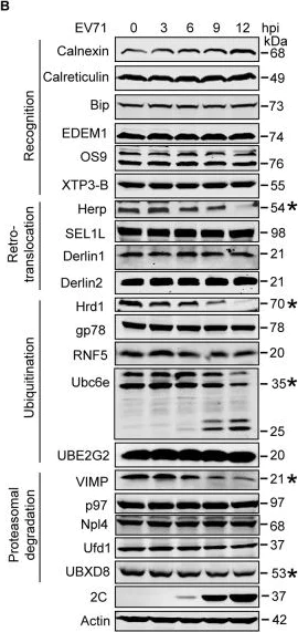 Western blot - Anti-ERLEC1 antibody [EPR13849] (AB181166)