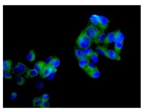 Immunocytochemistry/ Immunofluorescence - Anti-Erlin-2 antibody [EPR8088] (AB129207), expandable thumbnail