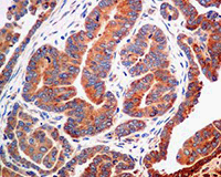 Immunohistochemistry (Formalin/PFA-fixed paraffin-embedded sections) - Anti-Erlin-2 antibody [EPR8088] (AB129207), expandable thumbnail