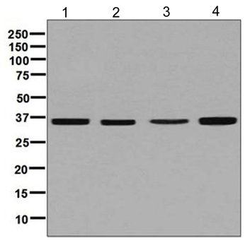 Western blot - Anti-Erlin-2 antibody [EPR8088] (AB129207), expandable thumbnail