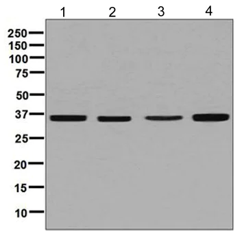 Western blot - Anti-Erlin-2 antibody [EPR8088] (AB129207)