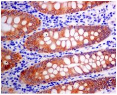 Immunohistochemistry (Formalin/PFA-fixed paraffin-embedded sections) - Anti-Erlin-2 antibody [EPR8089] - BSA and Azide free (AB248223), expandable thumbnail