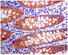 Immunohistochemistry (Formalin/PFA-fixed paraffin-embedded sections) - Anti-Erlin-2 antibody [EPR8089] - BSA and Azide free (AB248223)