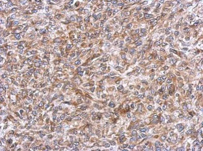 Immunohistochemistry (Formalin/PFA-fixed paraffin-embedded sections) - Anti-ERLIN1 antibody (AB229261)