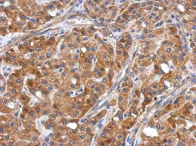 Immunohistochemistry (Formalin/PFA-fixed paraffin-embedded sections) - Anti-ERLIN1 antibody (AB229261)