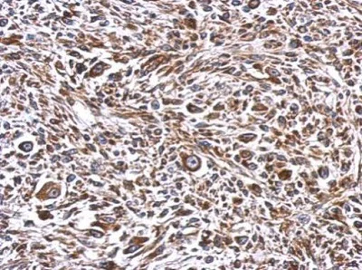 Immunohistochemistry (Formalin/PFA-fixed paraffin-embedded sections) - Anti-ERLIN1 antibody (AB229261)