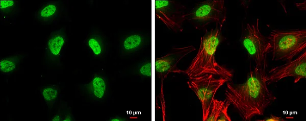 Immunocytochemistry/ Immunofluorescence - Anti-ERM / Etv5 antibody (AB102010)