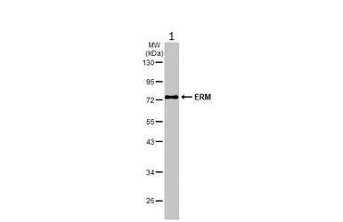 Western blot - Anti-ERM / Etv5 antibody (AB102010)