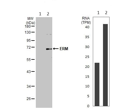 Western blot - Anti-ERM / Etv5 antibody (AB102010)