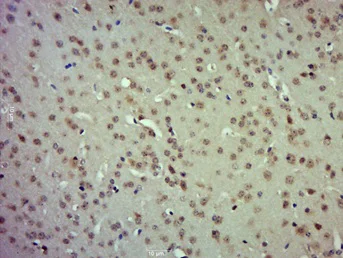 Immunohistochemistry (Formalin/PFA-fixed paraffin-embedded sections) - Anti-ERM / Etv5 antibody (AB217952)