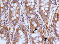Immunohistochemistry (Formalin/PFA-fixed paraffin-embedded sections) - Anti-ERO1L antibody [EPR12474] (AB177156), expandable thumbnail