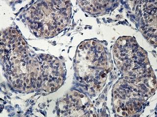Immunohistochemistry (Formalin/PFA-fixed paraffin-embedded sections) - Anti-ERO1LB antibody (AB197290), expandable thumbnail