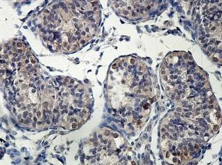 Immunohistochemistry (Formalin/PFA-fixed paraffin-embedded sections) - Anti-ERO1LB antibody (AB197290)