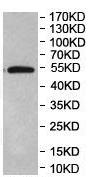 Western blot - Anti-ERO1LB antibody (AB197290), expandable thumbnail