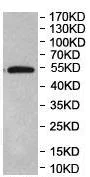 Western blot - Anti-ERO1LB antibody (AB197290)