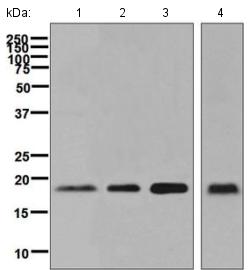 Western blot - Anti-ERp18 antibody [EPR9024] (AB134938)