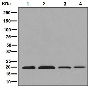 Western blot - Anti-ERp18 antibody [EPR9025] (AB137035)