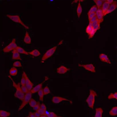 Immunocytochemistry/ Immunofluorescence - Anti-ERp29 antibody (AB11420)