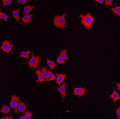 Immunocytochemistry/ Immunofluorescence - Anti-ERp29 antibody (AB11420)