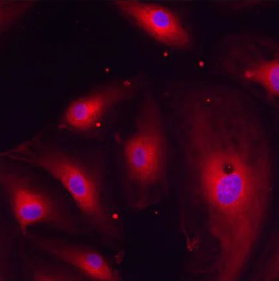 Immunocytochemistry/ Immunofluorescence - Anti-ERp29 antibody (AB11420)