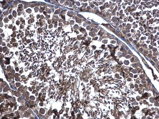 Immunohistochemistry (Formalin/PFA-fixed paraffin-embedded sections) - Anti-ERp57 antibody (AB228789)