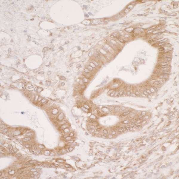 Immunohistochemistry (Formalin/PFA-fixed paraffin-embedded sections) - Anti-ERp57 antibody (AB264384)