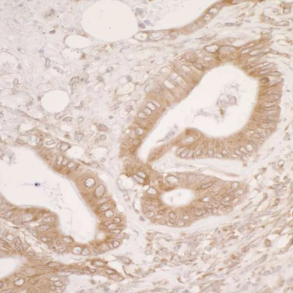 Immunohistochemistry (Formalin/PFA-fixed paraffin-embedded sections) - Anti-ERp57 antibody (AB264384)