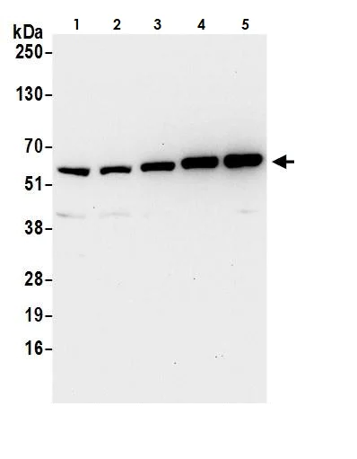 Western blot - Anti-ERp57 antibody (AB264384)