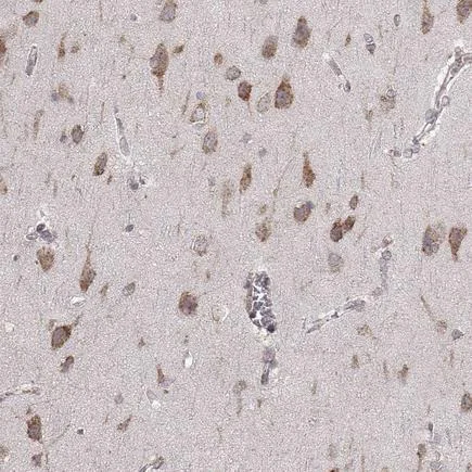 Immunohistochemistry (Formalin/PFA-fixed paraffin-embedded sections) - Anti-ERp57 antibody [CL2444] (AB242367)